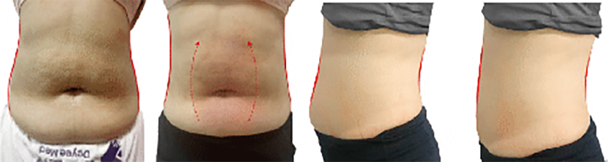 เอฟเฟกต์-4