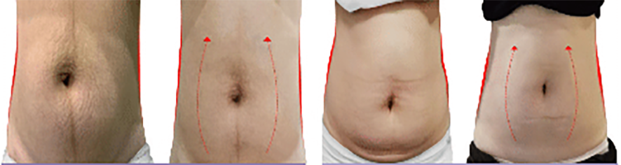 เอฟเฟกต์-2